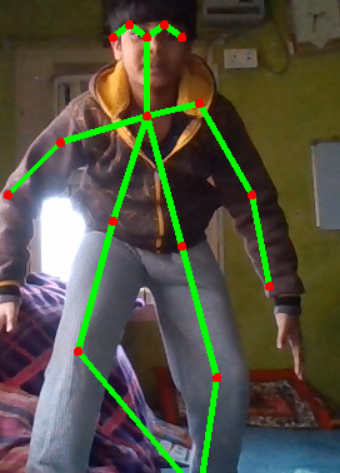 Pose Estimation